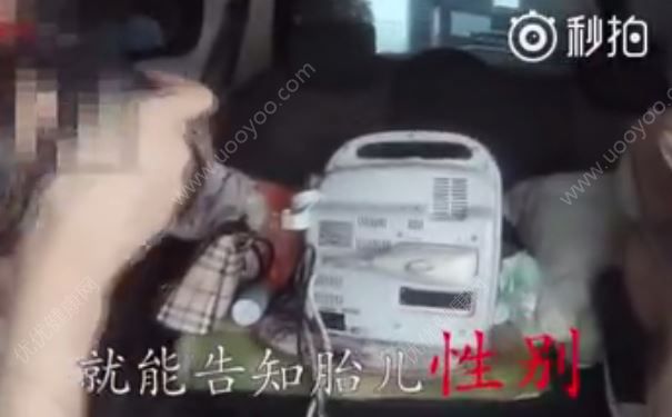 机动车流动作案非法鉴定胎儿性别，3分钟告知结果(1)