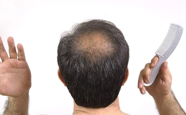 男人脱发吃什么食物好？男性脱发吃什么食物治疗？(1)
