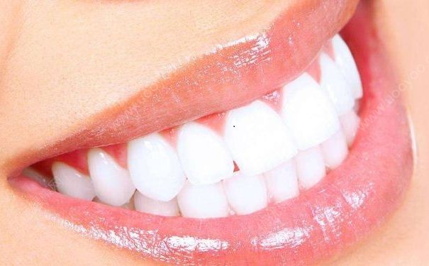 如何快速的美白牙齿？牙齿变白有什么方法？[图]
