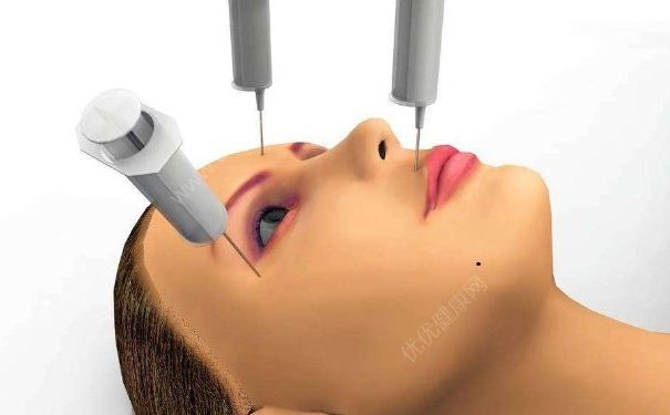 除皱术与拉皮术有何区别？除皱术要做什么准备？[图]
