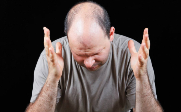 男性中年如何预防脱发？中年男性预防脱发的方法有哪些？(1)