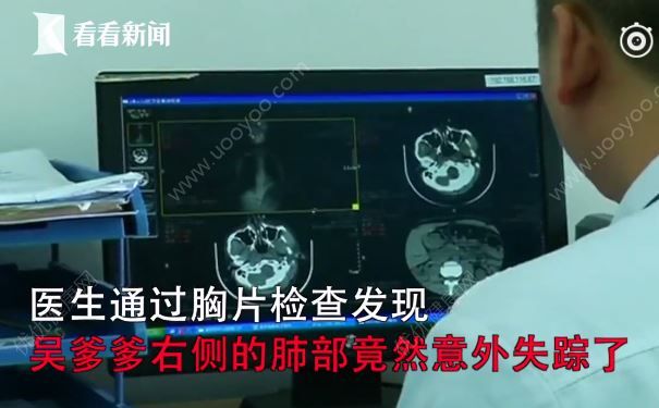 大爷没事在家拔火罐，不料竟把右肺给拔没了(3)