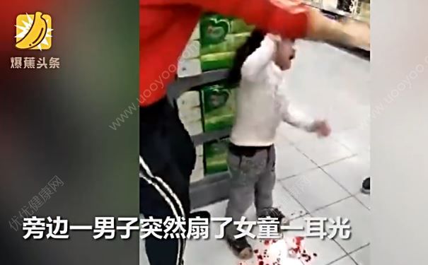 爷爷超市扇女童致其鼻子流血不止，大哭后又被扇一记耳光(2)