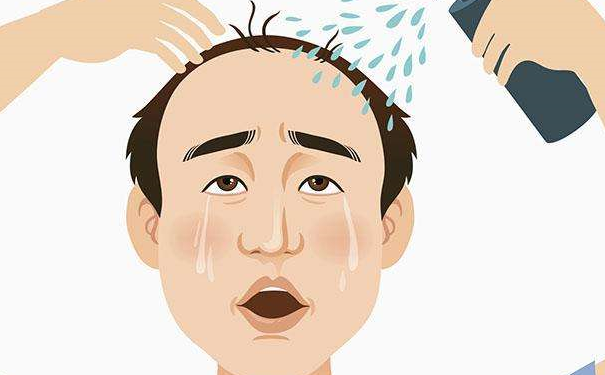 男人脱发吃什么能调理？男人脱发吃什么好呢？(1)