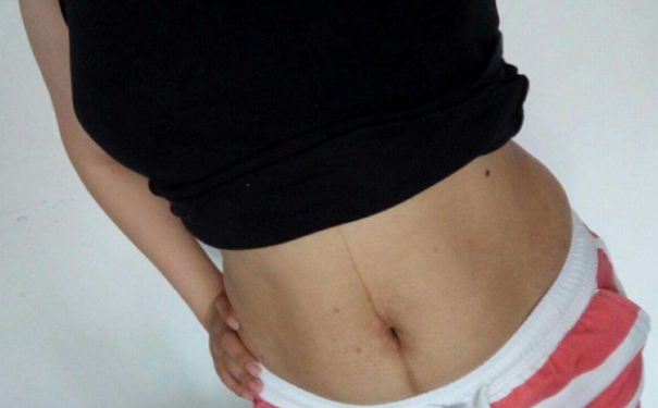 如何通过饮食来减肚子？饮食减掉大肚腩的方法有哪些？(1)