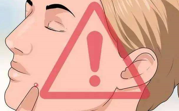 挤痘痘后如何避免皮肤发炎？怎么防止留下痘印？(1)