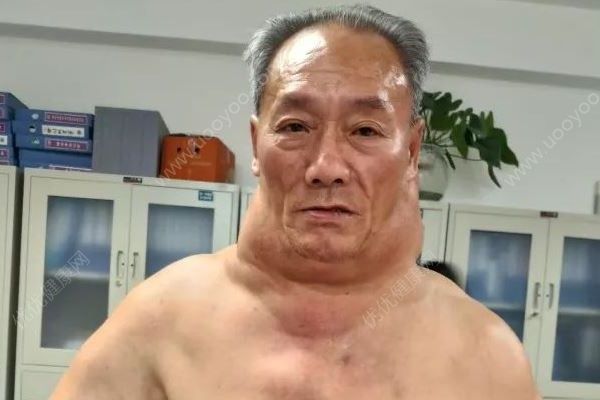 每天2斤白酒，脖子比腰粗，大爷喝酒55年成绿巨人[多图]