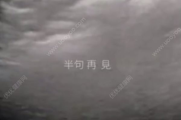 孙燕姿晒二胎宝宝B超视频做新歌预告，怀二胎要注意什么？(3)
